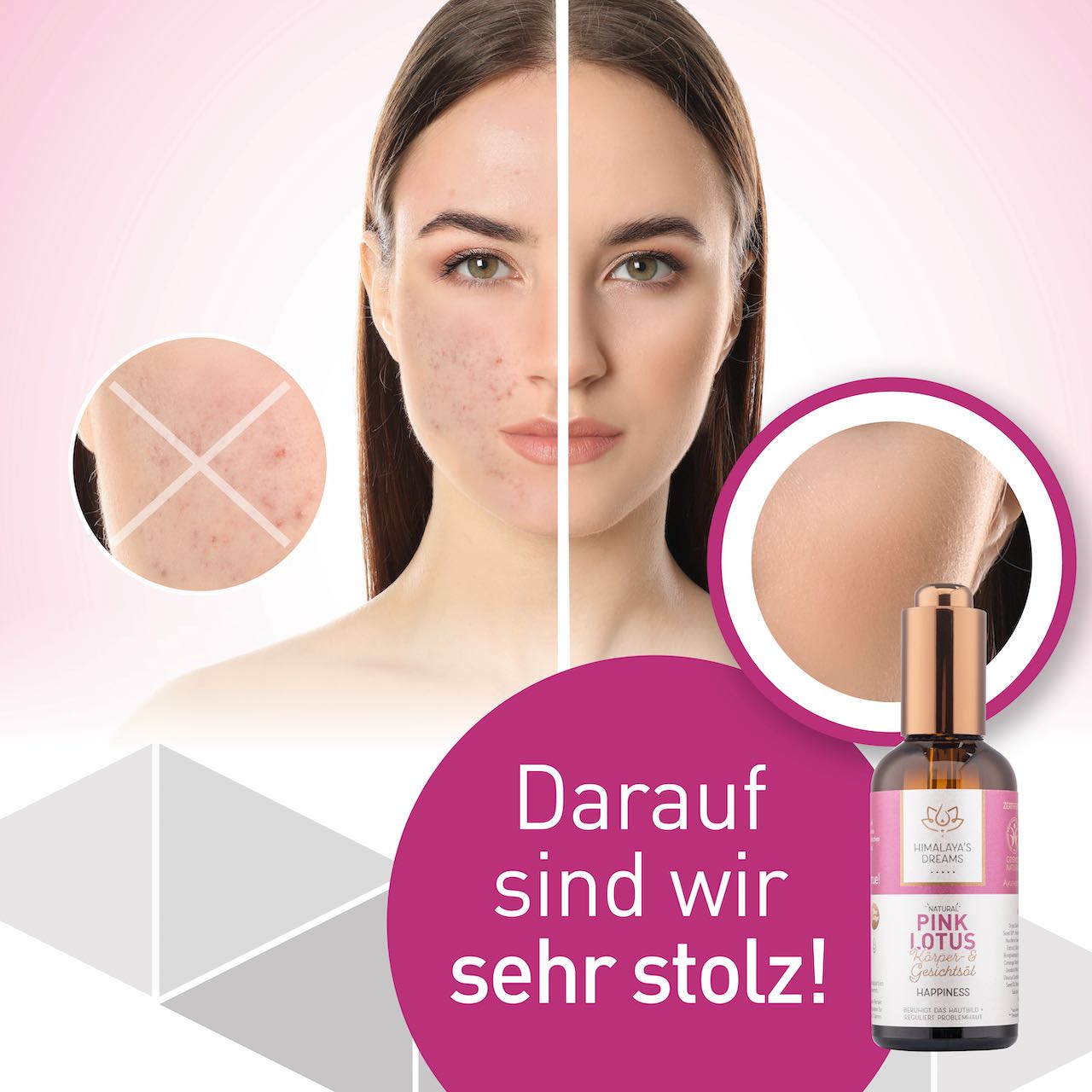 Ayurveda Körper- und Gesichtsöl Pink Lotus/Happiness 100ml