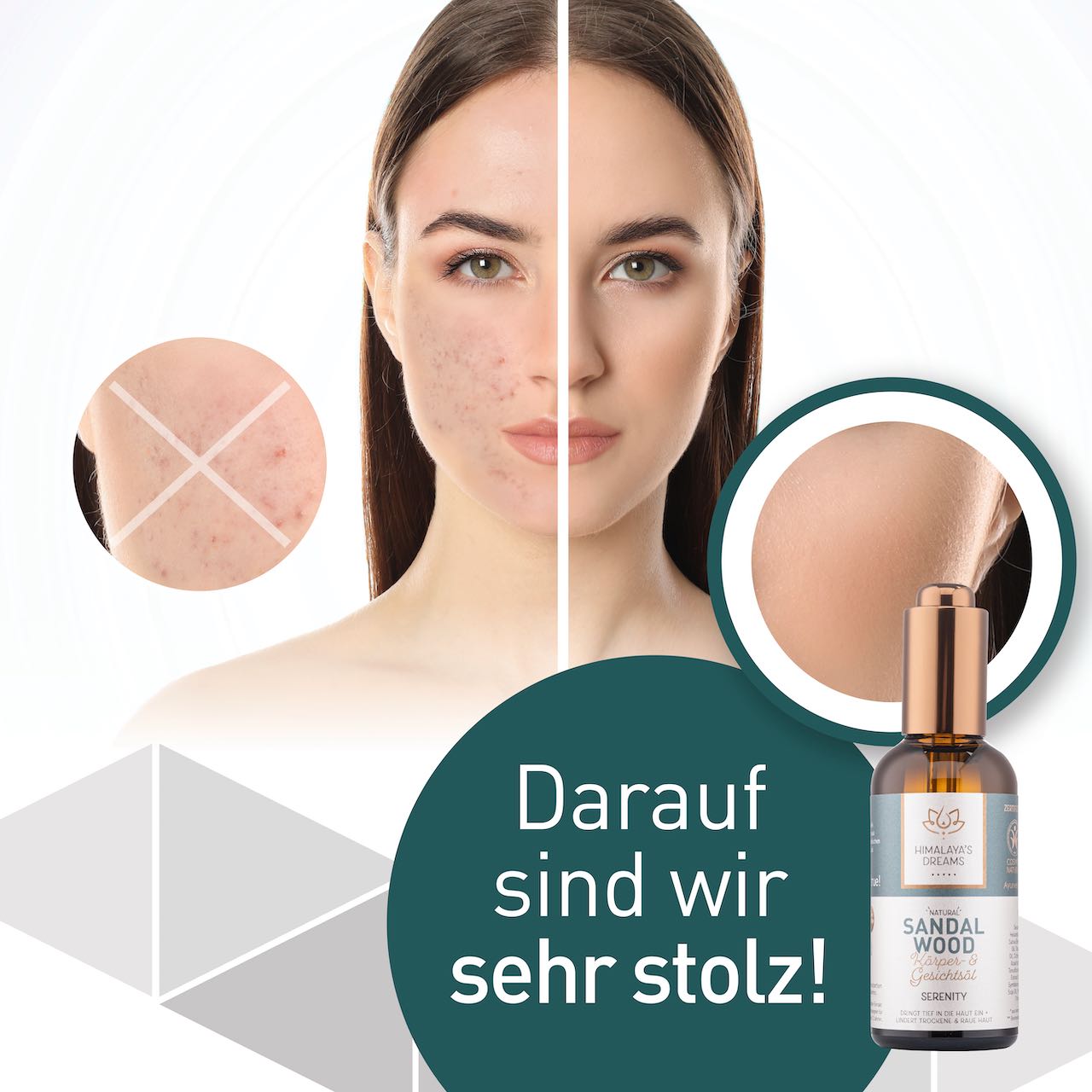 Ayurveda Körper- und Gesichtsöl Sandelholz/Serenity 100ml